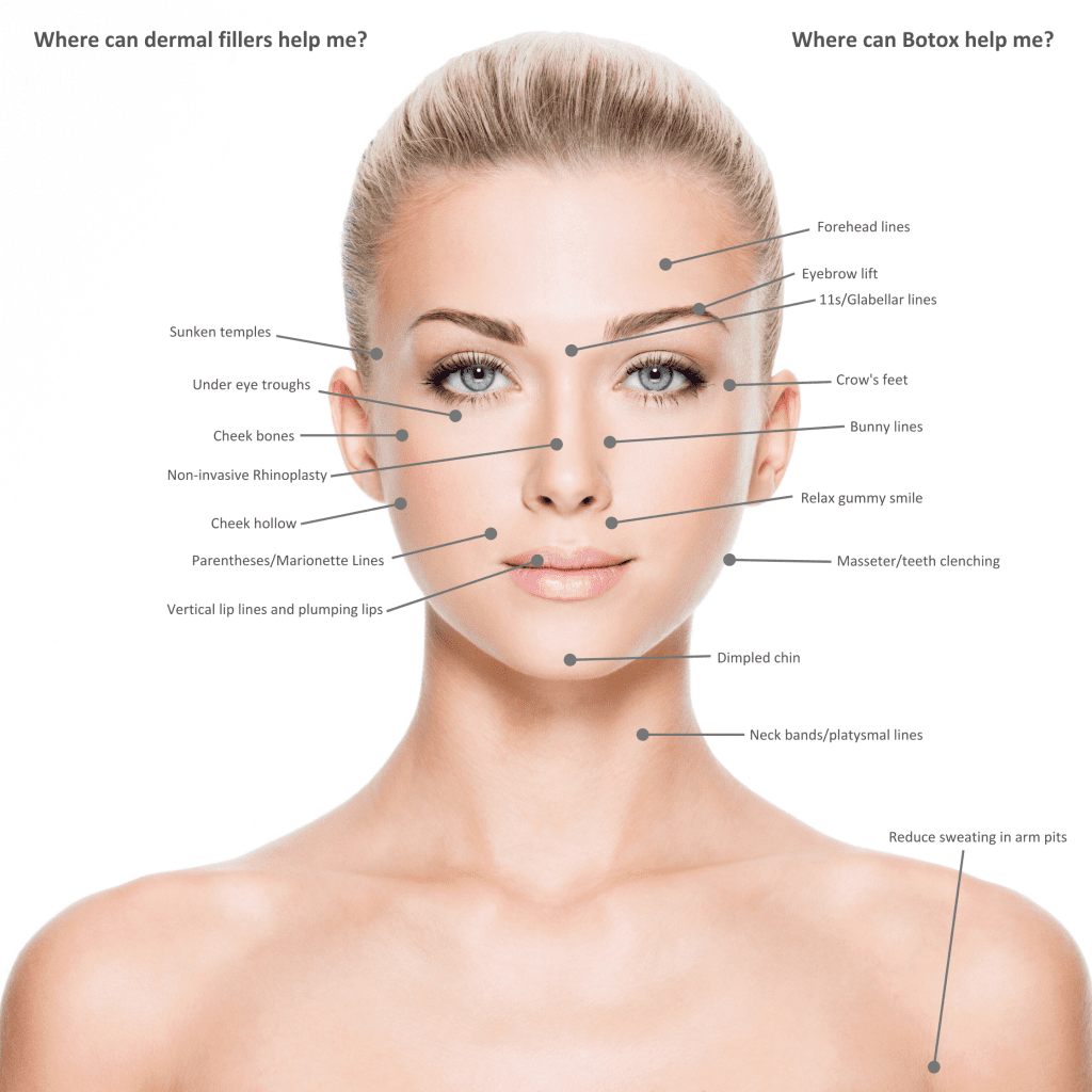 juvederm treatment options in bend oregon